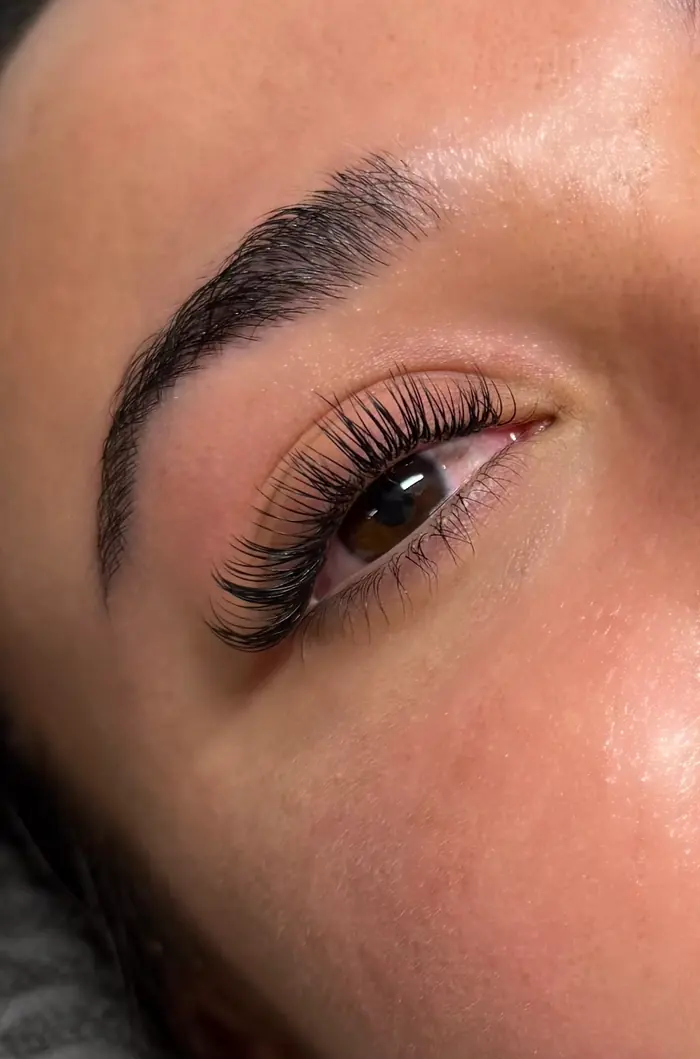 Sourcils restructurés au brow lift
